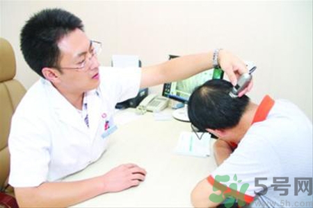 脫發(fā)會(huì)遺傳嗎？脫發(fā)遺傳可以治療嗎？