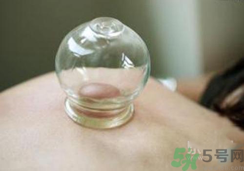 拔火罐和拔氣罐哪個好？拔火罐和拔氣罐的區(qū)別