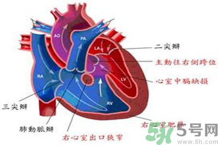 先天性心臟病發(fā)病原因是什么？