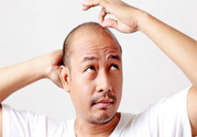 脫發(fā)的高發(fā)人群有哪些？如何預(yù)防脫發(fā)？