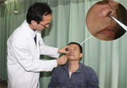 鼻咽癌的發(fā)病因素是什么？鼻咽癌的并發(fā)癥有哪些？