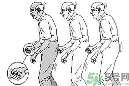 帕金森要注意哪些措施？帕金森的飲食需注意什么？