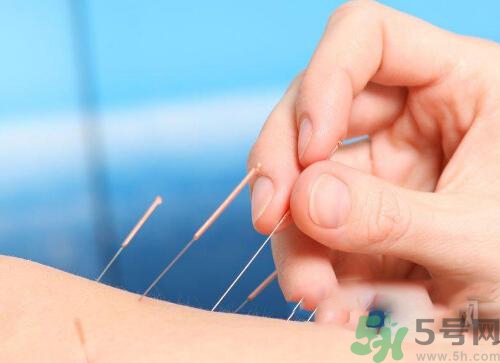 埋線(xiàn)減肥多少錢(qián)一次？埋線(xiàn)減肥的副作用