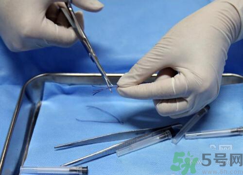 埋線減肥多少錢一次？埋線減肥的副作用