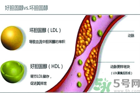 人體中的膽固醇分好壞嗎？如何區(qū)分膽固醇的好壞？