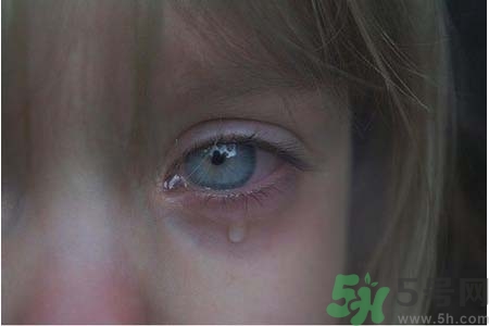 睡覺時(shí)流眼淚是怎么回事？如何保護(hù)眼睛？