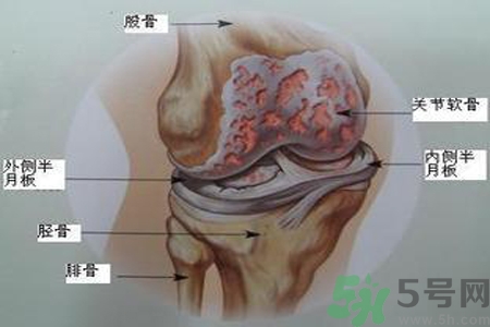 預(yù)防骨病需要注意哪些姿勢？秋季預(yù)防骨病的方法有哪些？