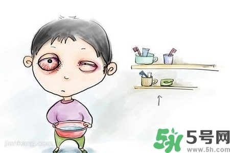 寶寶為什么會(huì)感染紅眼??？寶寶患紅眼病如何治療？