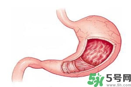 急性腸胃炎哪些食物不可以吃？急性腸胃炎不能吃的水果有？