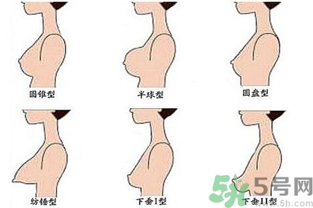 ?女性乳房下垂的原因是什么？女性乳房下垂的分類有哪些？