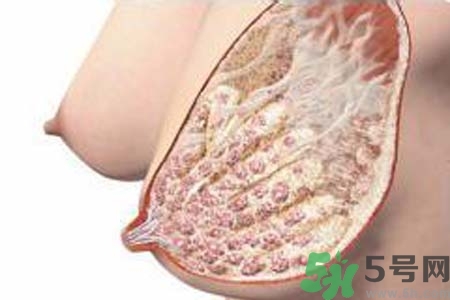 乳腺增生治療方法是什么？乳腺增生的檢查方法有哪些？
