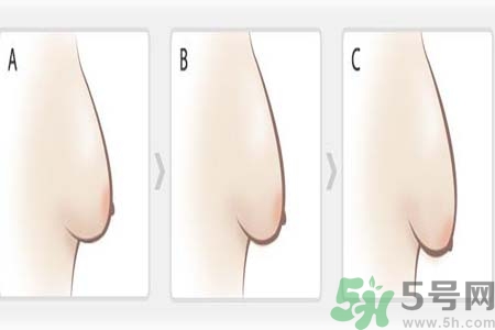 胸部松弛的原因是什么？胸部松弛該怎么辦？