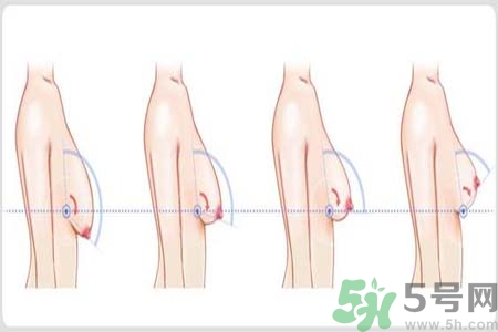胸部松弛的原因是什么？胸部松弛該怎么辦？