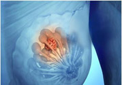 乳房有硬塊正常嗎？乳房有腫塊怎么回事？