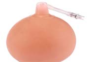 乳頭內(nèi)陷可以拔罐嗎？乳頭內(nèi)陷需要手術(shù)治療嗎？