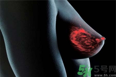 乳房上有硬塊怎么辦？乳房有硬塊的病因是什么？