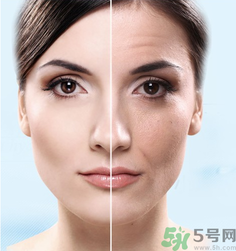什么是3D液態(tài)拉皮？3D液態(tài)拉皮效果怎么樣？