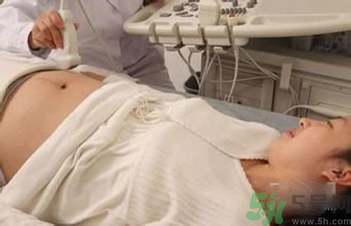 孕婦做b超要空腹嗎？孕婦做b超要不要空腹？