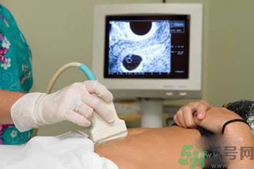 孕婦做b超要空腹嗎？孕婦做b超要不要空腹？