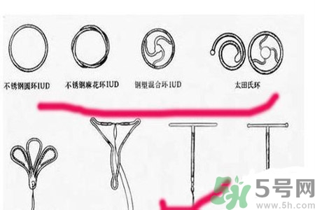 什么是宮內(nèi)節(jié)育器？放置宮內(nèi)節(jié)育器為什么能避孕？