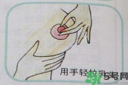 乳頭內(nèi)陷怎么矯正？乳頭內(nèi)陷矯正方法是什么？