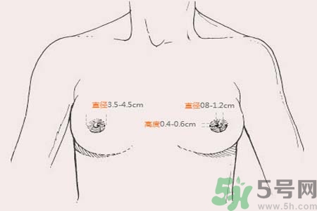 乳頭內(nèi)陷能不能喂奶？乳頭凹陷怎樣哺乳？