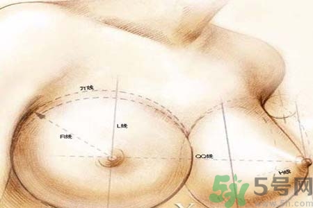 乳頭內(nèi)陷可以用吸奶器嗎？乳頭內(nèi)陷能不能用吸奶器？