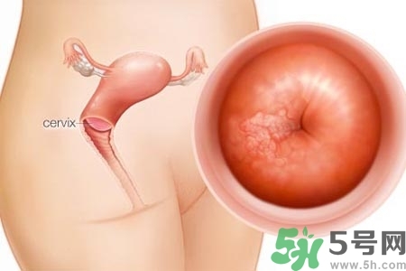陰道干澀是什么？陰道干澀的危害有什么？