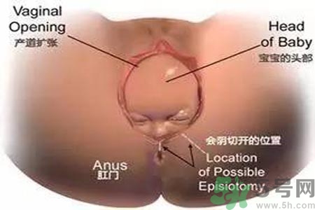 女性陰道松弛的原因是什么？女性陰道松弛怎么辦？
