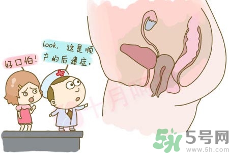陰道松弛是什么？陰道松弛的癥狀有哪些？
