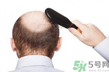 男性衰老的征兆有哪些？男性10個(gè)難以逆轉(zhuǎn)的衰老征兆