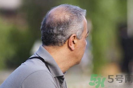 男性衰老的征兆有哪些？男性10個(gè)難以逆轉(zhuǎn)的衰老征兆