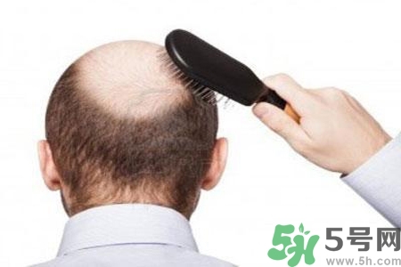 男性防止性衰老決竅有哪些？男性受用一生抵抗衰老法則