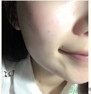 麗得姿面膜適合孕婦可以用嗎？麗得姿面膜哪些孕婦可以用？