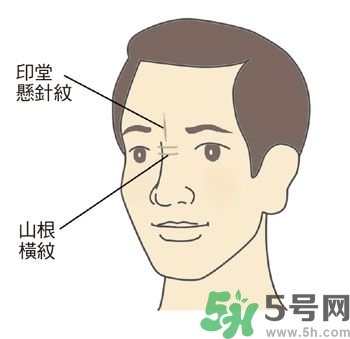 耳垂上有豎紋是怎么回事？山根有橫紋是什么??？