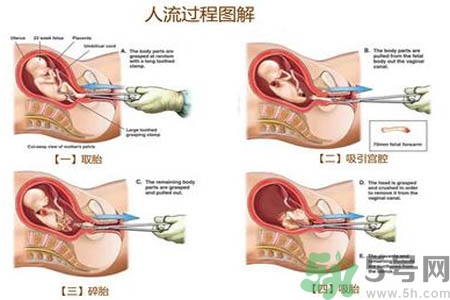 人流后怎么調(diào)養(yǎng)身體？人流后飲食需注意什么？
