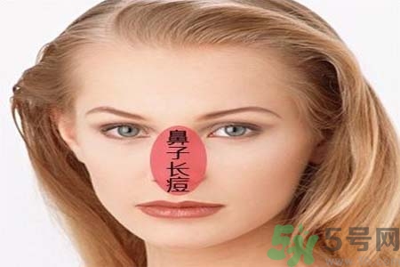 鼻翼長痘痘怎么回事？鼻翼長痘痘的原因是什么？
