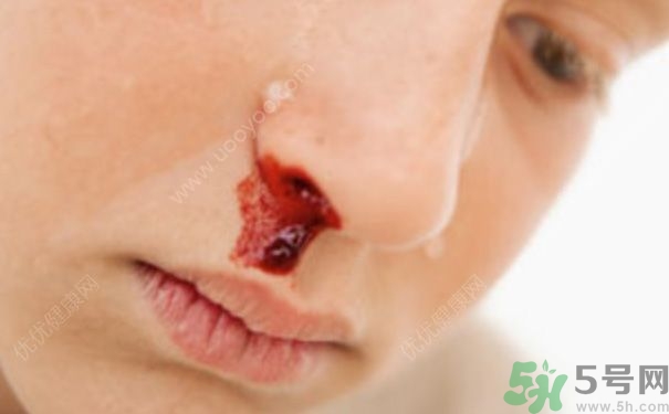 15歲男孩可以刮胡子嗎？15歲男孩經(jīng)常流鼻血怎么回事？