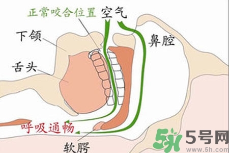 鼻子紅是什么原因？鼻子紅怎么辦？