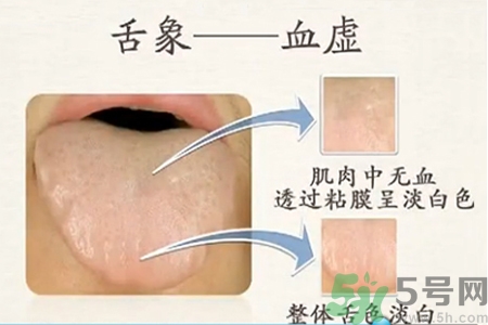 血虛的癥狀是什么？血虛的表現(xiàn)有哪些？