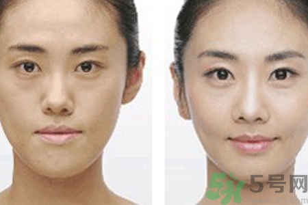激光縮毛孔多少錢一次？激光縮毛孔一個療程多少錢？
