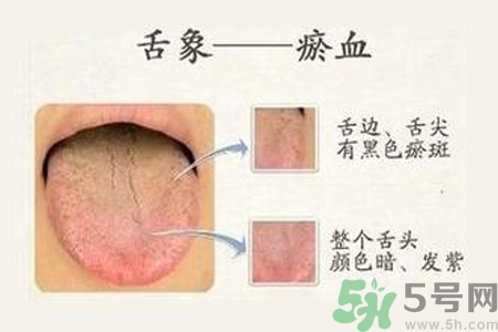 血瘀體質(zhì)吃什么？血瘀體質(zhì)怎么調(diào)理？
