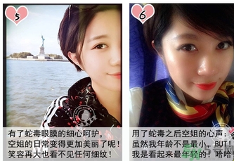 蛇毒眼膜孕婦可以用嗎？ 日本spa蛇毒眼膜孕婦能用嗎？