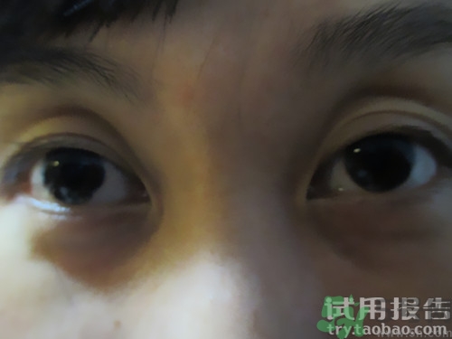 蛇毒眼膜效果怎么樣？spa蛇毒眼膜紅色好用嗎？