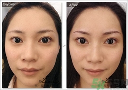 眉毛怎么整形好看？眉毛怎么整自然？