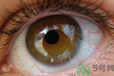 ?干眼癥的治療方法是什么？如何預(yù)防干眼癥？