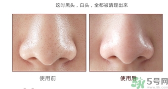 yu.r巧克力棒鼻貼怎么樣？yu.r巧克力鼻貼好用嗎？