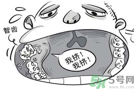 智齒拔了好不好？智齒能不拔嗎？