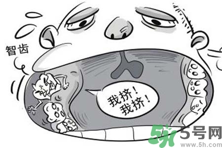 智齒橫著長(zhǎng)怎么辦？智齒橫著長(zhǎng)一定要拔了嗎？