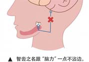 長智齒疼痛怎么辦？長智齒牙齦腫了怎么辦？